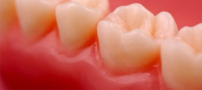 What it Gingivitis and How Can I Get Rid of It?
